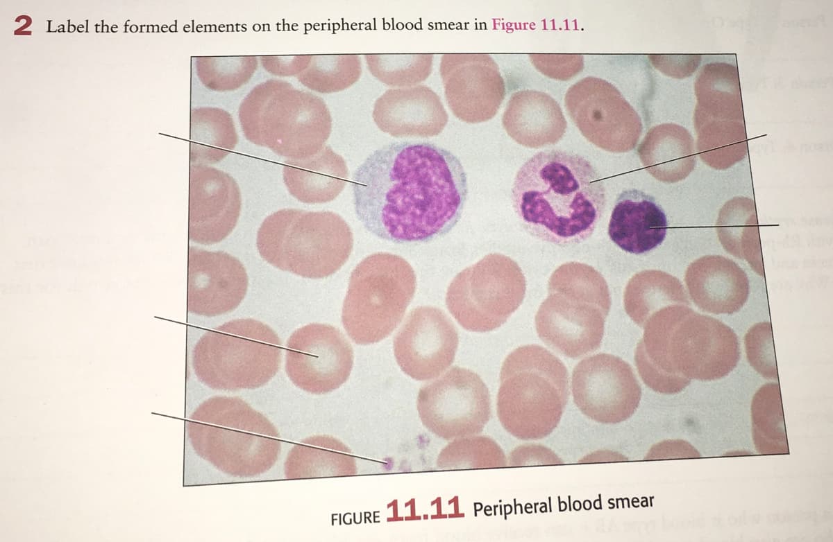 2 Label the formed elements on the peripheral blood smear in Figure 11.11.
FIGURE 11.11 Peripheral blood smear
