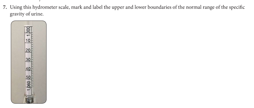 7. Using this hydrometer scale, mark and label the upper and lower boundaries of the normal range of the specific
gravity of urine.
1,0601,000
20
30