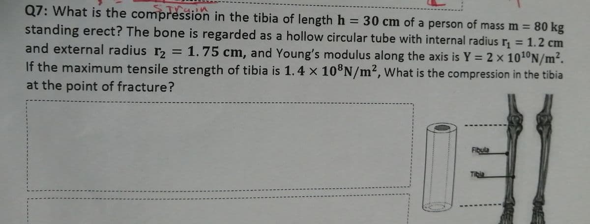 Q7: What is the compression in the tibia of lengthh = 30 cm of a person of mass m =
standing erect? The bone is regarded as a hollow circular tube with internal radius r, = 1.2 cm
and external radius r, = 1.75 cm, and Young's modulus along the axis is Y = 2 × 1010N/m².
If the maximum tensile strength of tibia is 1.4 × 10®N/m², What is the compression in the tibia
at the point of fracture?
80 kg
%3D
Fibula
1.
Tibia
