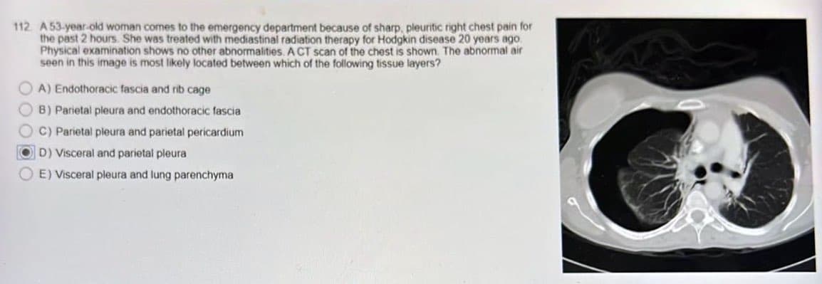 112 A 53-year-old woman comes to the emergency department because of sharp, pleuritic right chest pain for
the past 2 hours. She was treated with mediastinal radiation therapy for Hodgkin disease 20 years ago
Physical examination shows no other abnormalities. A CT scan of the chest is shown. The abnormal air
seen in this image is most likely located between which of the following tissue layers?
000
OA) Endothoracic fascia and rib cage
OB) Parietal pleura and endothoracic fascia
C) Parietal pleura and parietal pericardium
OD) Visceral and parietal pleura
E) Visceral pleura and lung parenchyma