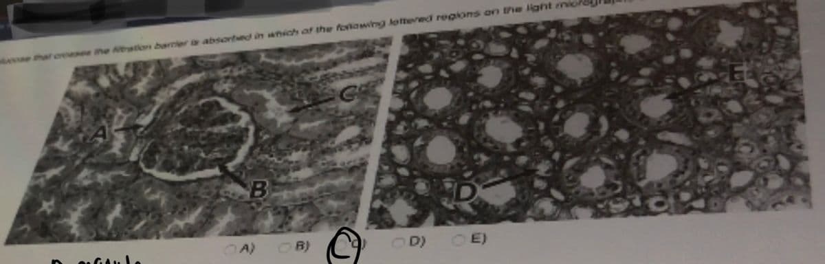 ce that crosses the fitration barrier absorbed in which of the following lettered regions on the light
oftulo
B
OA)
OB)
C)
D)
E)