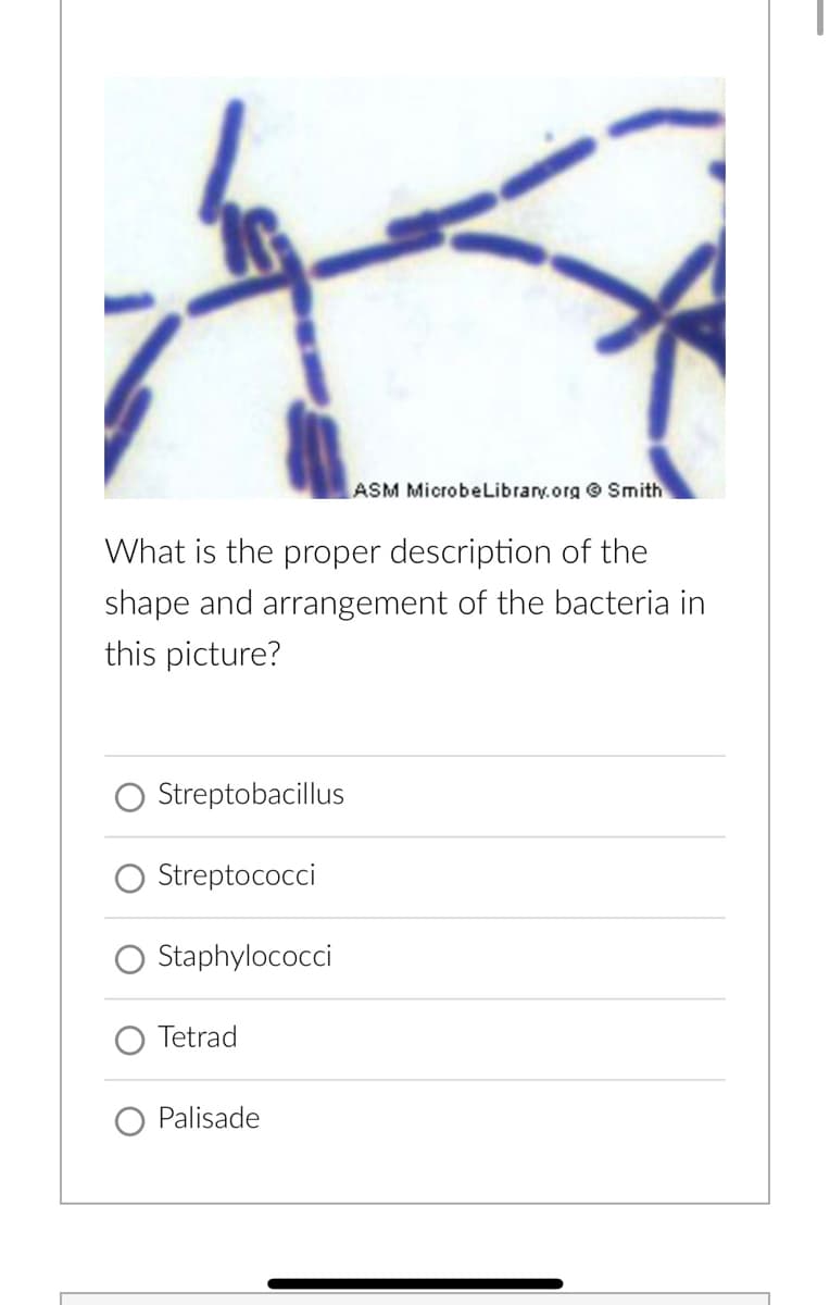 What is the proper description of the
shape and arrangement of the bacteria in
this picture?
Streptobacillus
Streptococci
Staphylococci
Tetrad
ASM MicrobeLibrary.org Smith
Palisade