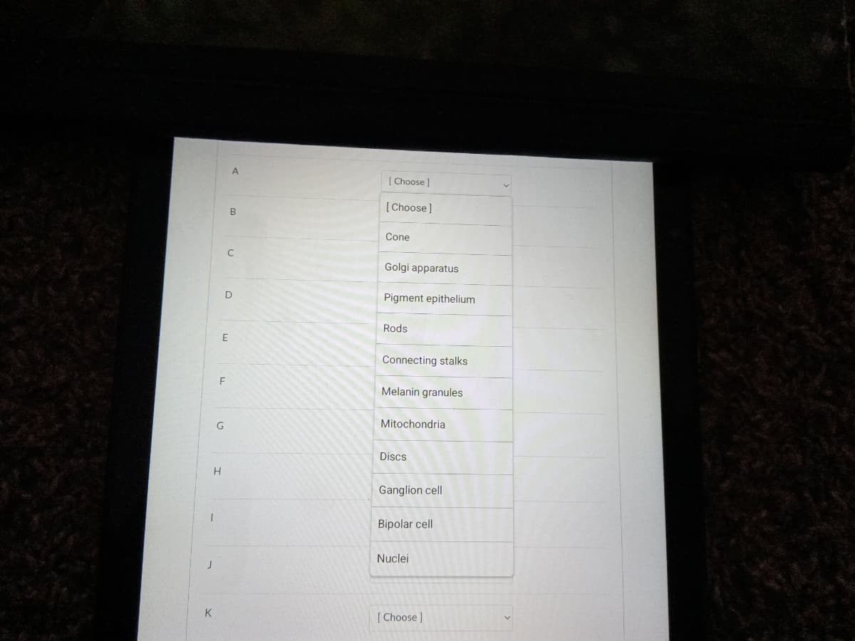 The image appears to display a list with selectable options. On an educational website, this could be used for a matching activity related to cellular biology or a specific lesson on the anatomy of the eye. Below is a transcript of the image content, organized as it might appear on the website:

---

### Matching Activity: Cellular Components and Functions

Select the correct term from the dropdown list for each lettered item.

| Letter | Term                                                      |
|--------|-----------------------------------------------------------|
| A      | [Choose]                                                  |
| B      | Cone                                                      |
| C      | Golgi apparatus                                           |
| D      | Pigment epithelium                                        |
| E      | Rods                                                      |
| F      | Connecting stalks                                         |
| G      | Melanin granules                                          |
| H      | Mitochondria                                              |
| I      | Discs                                                     |
| J      | Ganglion cell                                             |
| K      | Bipolar cell                                              |
| L      | Nuclei                                                    |

---

This activity could help users reinforce their understanding of cellular structures and their functions, particularly in the context of photoreceptor cells in the retina. Each dropdown menu allows users to select the appropriate term for each corresponding letter, facilitating interactive learning.
