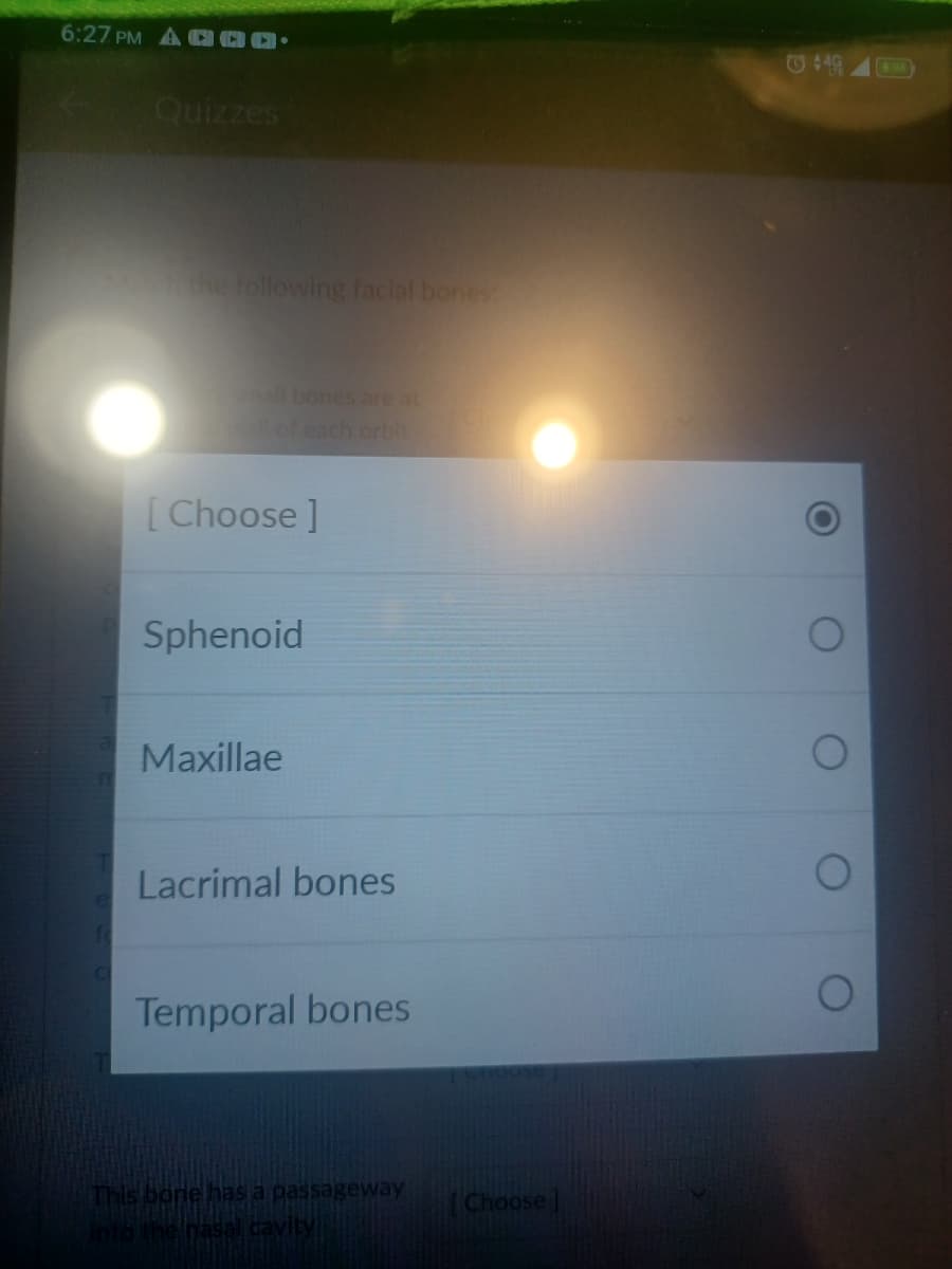 6:27 PM A
Quizzes
ich the following facial bones
small bones are at
[Choose ]
Sphenoid
Maxillae
Lacrimal bones
Temporal bones
This bone has a passageway
into the nasal cavity
Choose
Ⓒ449