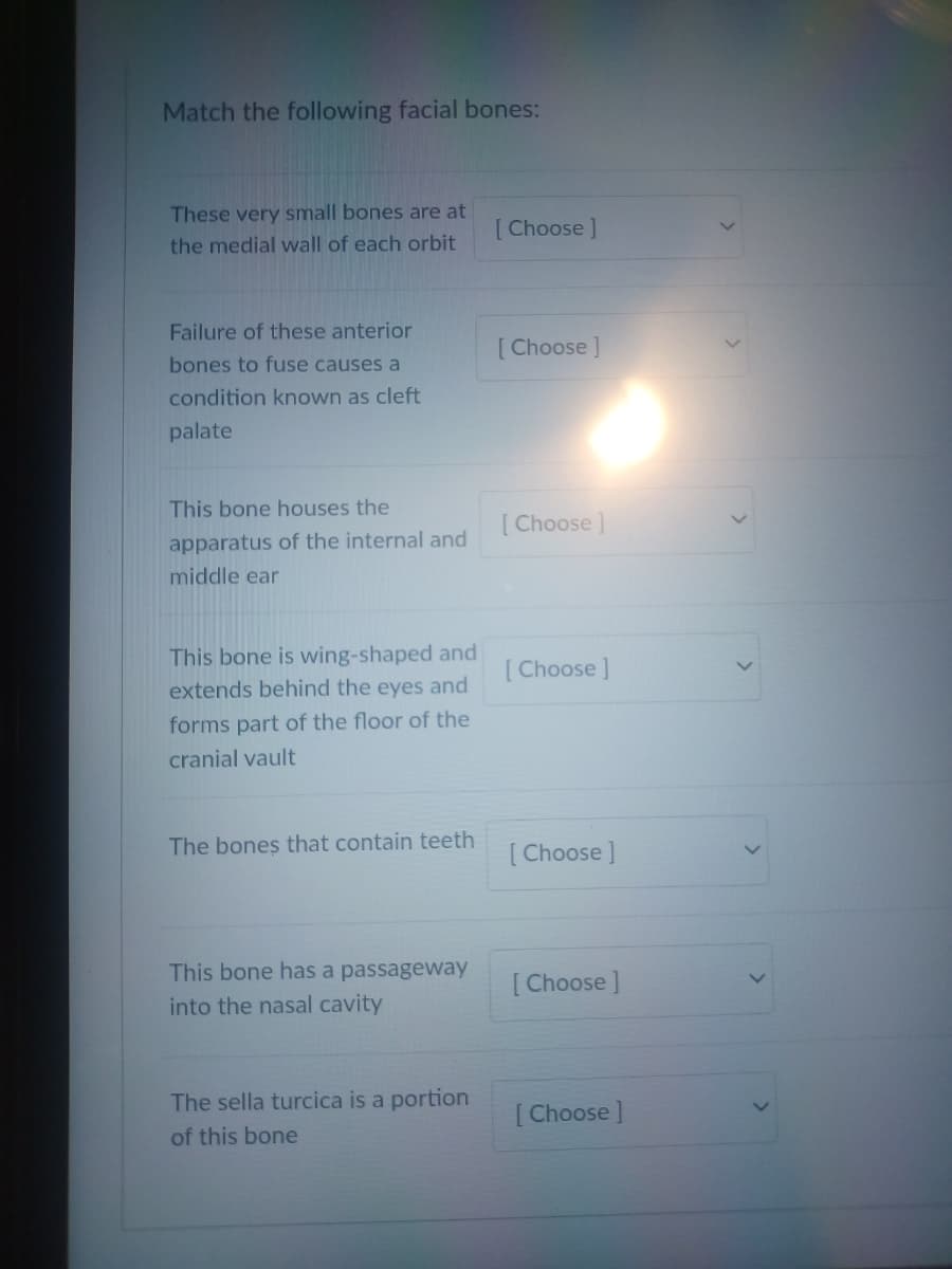 Match the following facial bones:
These very small bones are at
the medial wall of each orbit
Failure of these anterior
bones to fuse causes a
condition known as cleft
palate
This bone houses the
apparatus of the internal and
middle ear
This bone is wing-shaped and
extends behind the eyes and
forms part of the floor of the
cranial vault
The bones that contain teeth
This bone has a passageway
into the nasal cavity
The sella turcica is a portion
of this bone
[Choose ]
[Choose ]
[Choose ]
[Choose]
[Choose ]
[Choose ]
[Choose ]