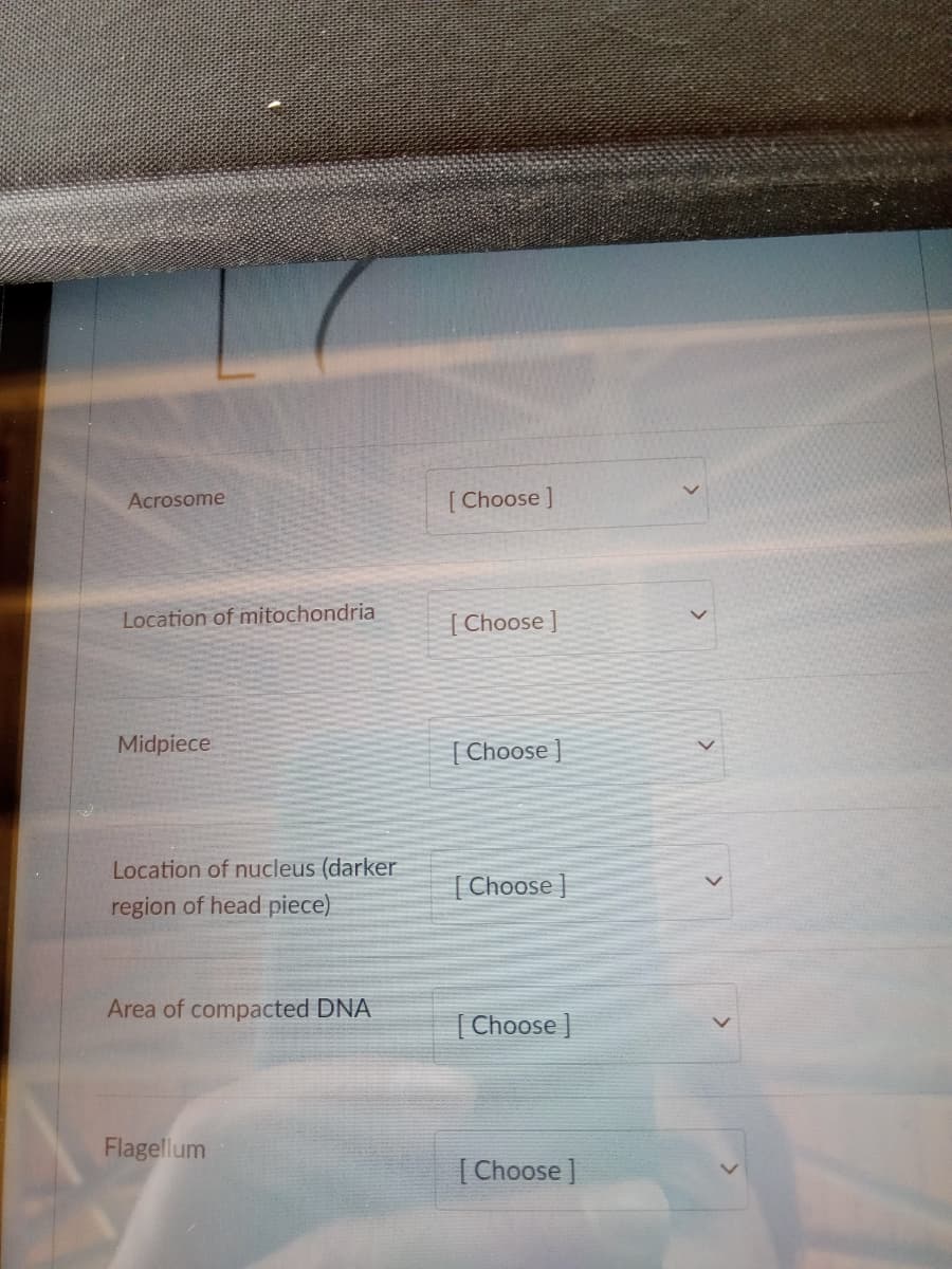 Acrosome
Location of mitochondria
Midpiece
Location of nucleus (darker
region of head piece)
Area of compacted DNA
Flagellum
[Choose ]
[Choose]
[Choose]
[Choose]
[Choose]
[Choose ]