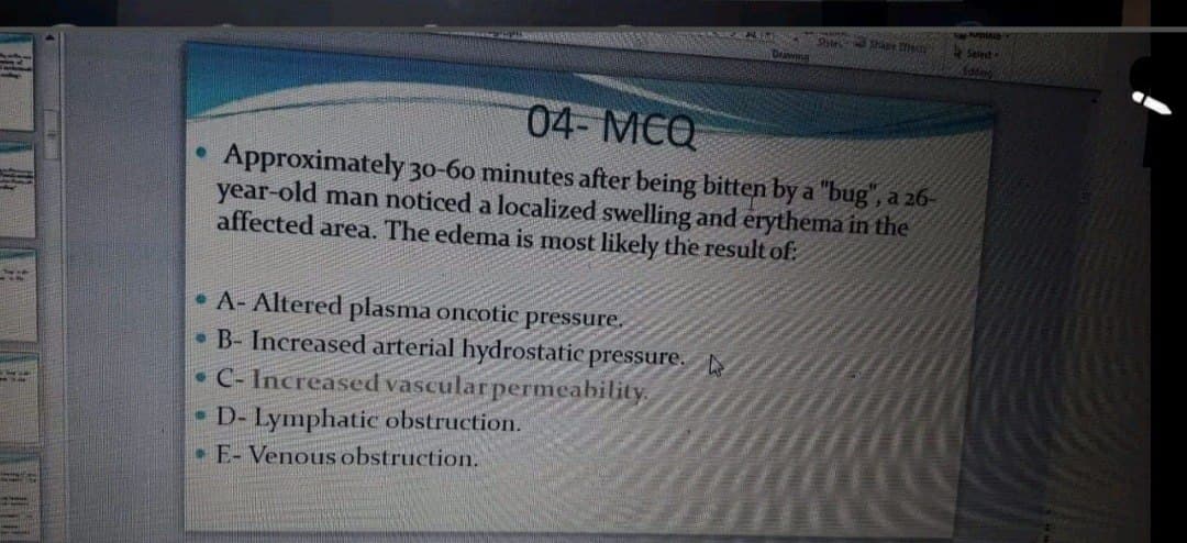 Shle d Shape eg
Drawng
Selest
04- MCQ
Approximately 30-60 minutes after being bitten by a "bug",
year-old man noticed a localized swelling and erythema in the
affected area. The edema is most likely the result of:
a 26-
• A- Altered plasma oncotic pressure.
• B- Increased arterial hydrostatic pressure.
• C- Increased vascular permeability.
- D- Lymphatic obstruction.
• E- Venous obstruction.
