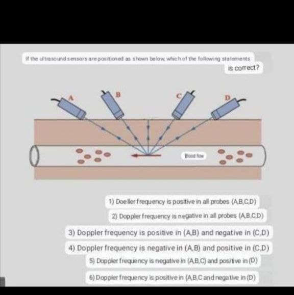 if the ultrasound sensors are positioned as shown below which of the following statements
is correct?
1) Doeller frequency is positive in all probes (AB,C,D)
2) Doppler frequency is negative in all probes (A,B,C,D)
3) Doppler frequency is positive in (AB) and negative in (C,D)
4) Doppler frequency is negative in (A,B) and positive in (C,D)
5) Doppler frequency is negative in (A,B,C) and positive in (D)
6) Doppler frequency is positive in (A,B,C and negative in (D)