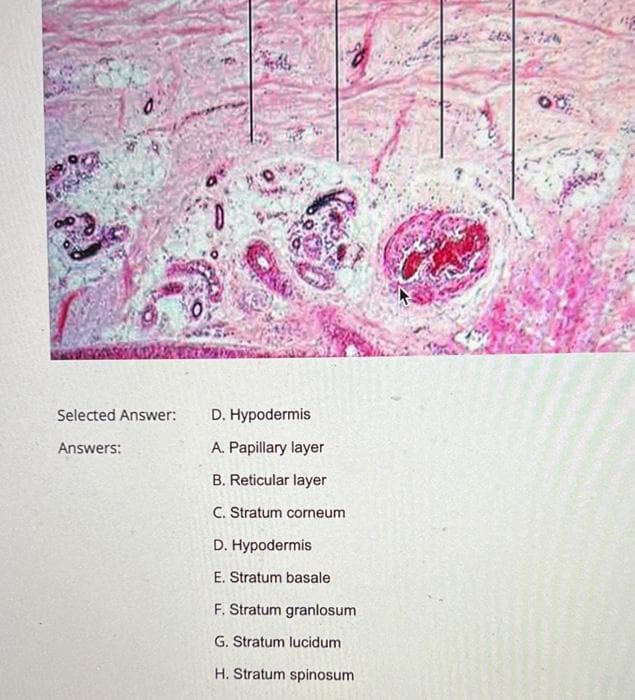 Selected Answer:
D. Hypodermis
Answers:
A. Papillary layer
B. Reticular layer
C. Stratum corneum
D. Hypodermis
E. Stratum basale
F. Stratum granlosum
G. Stratum lucidum
H. Stratum spinosum
