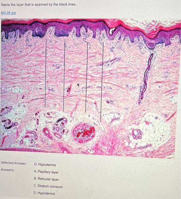 Name the layer that is spanned by the black lines.
M3-26.jpg
Selected Answer:
D. Hypodermis
Answers:
A Papillary layer
B. Reticular layer
C. Stratum comeum
D. Hypodermis
