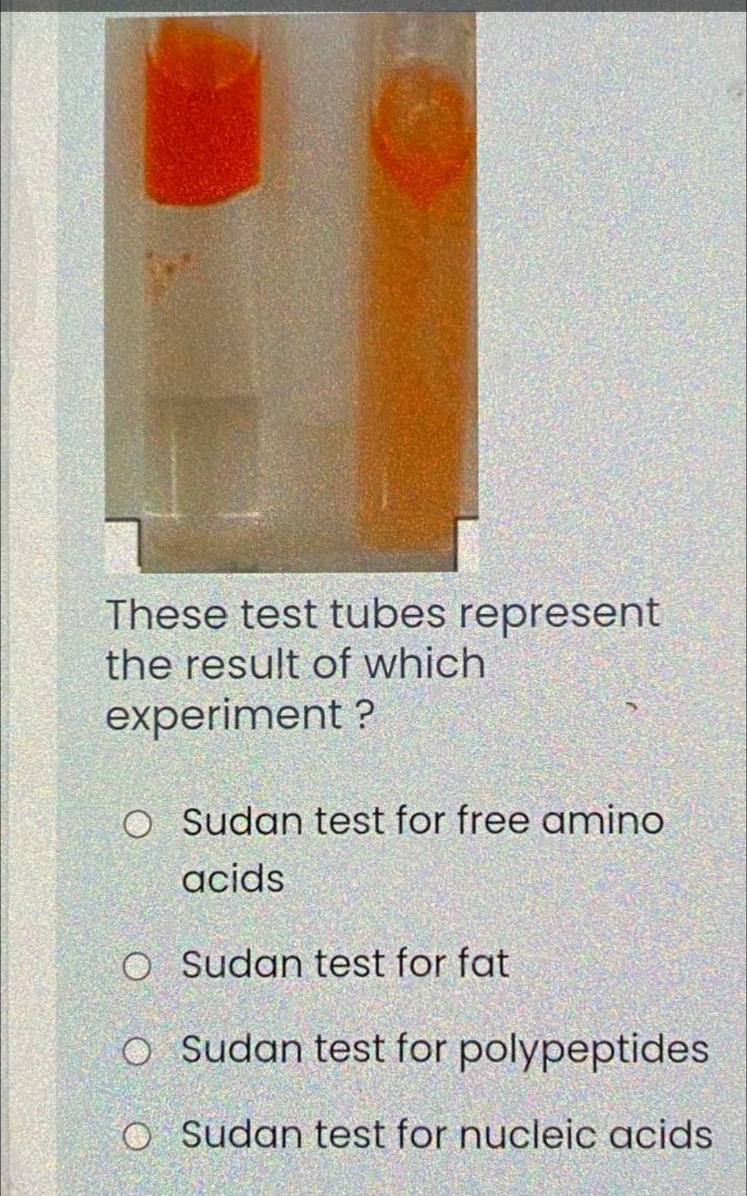 These test tubes represent
the result of which
experiment ?
O Sudan test for free amino
acids
O Sudan test for fat
O Sudan test for polypeptides
O Sudan test for nucleic acids
