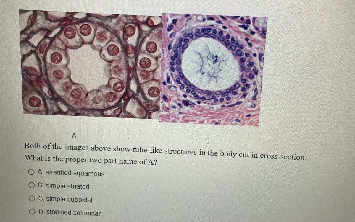 A
B.
Both of the images above show tube-like structures in the body cut in cross-section.
What is the proper two part name of A?
O A. stratified squamous
O B. simple striated
O C. simple cuboidal
O D. stratified columnar
