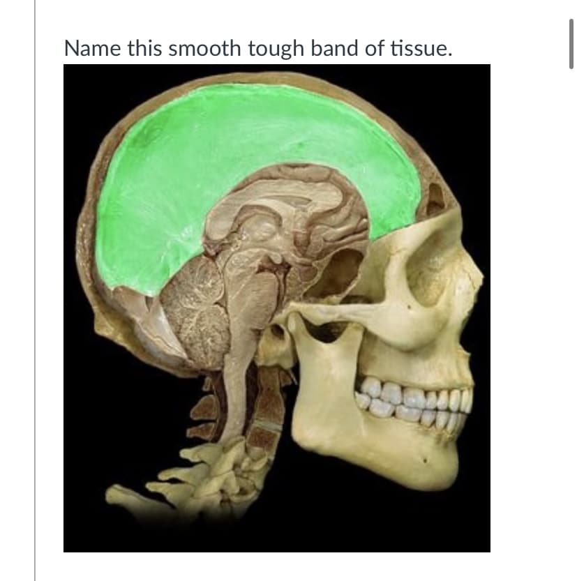 Name this smooth tough band of tissue.
