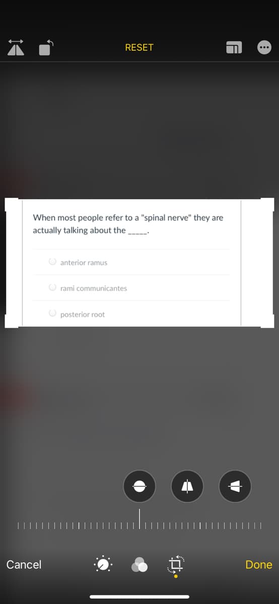 RESET
When most people refer to a "spinal nerve" they are
actually talking about the
-----
O anterior ramus
O rami communicantes
O posterior root
Cancel
Done
