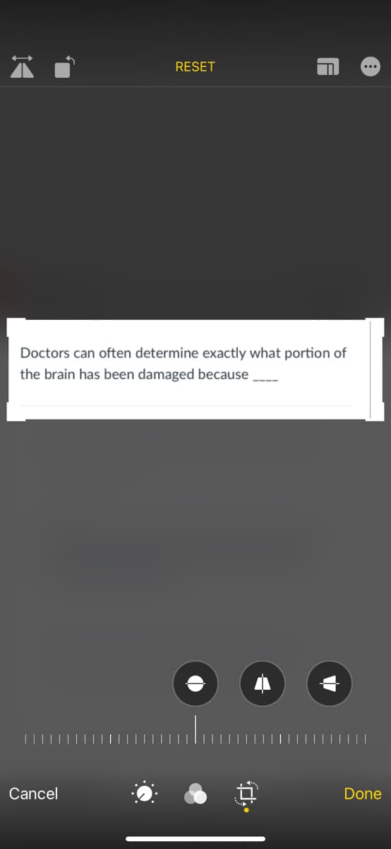 RESET
Doctors can often determine exactly what portion of
the brain has been damaged because
Cancel
Done
