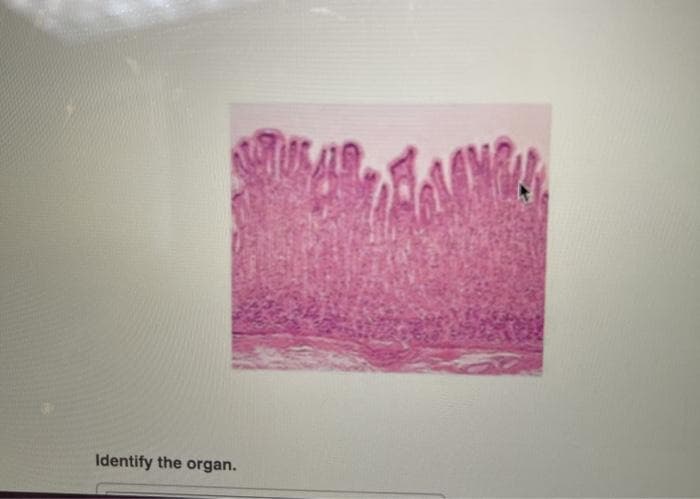 Identify the organ.
