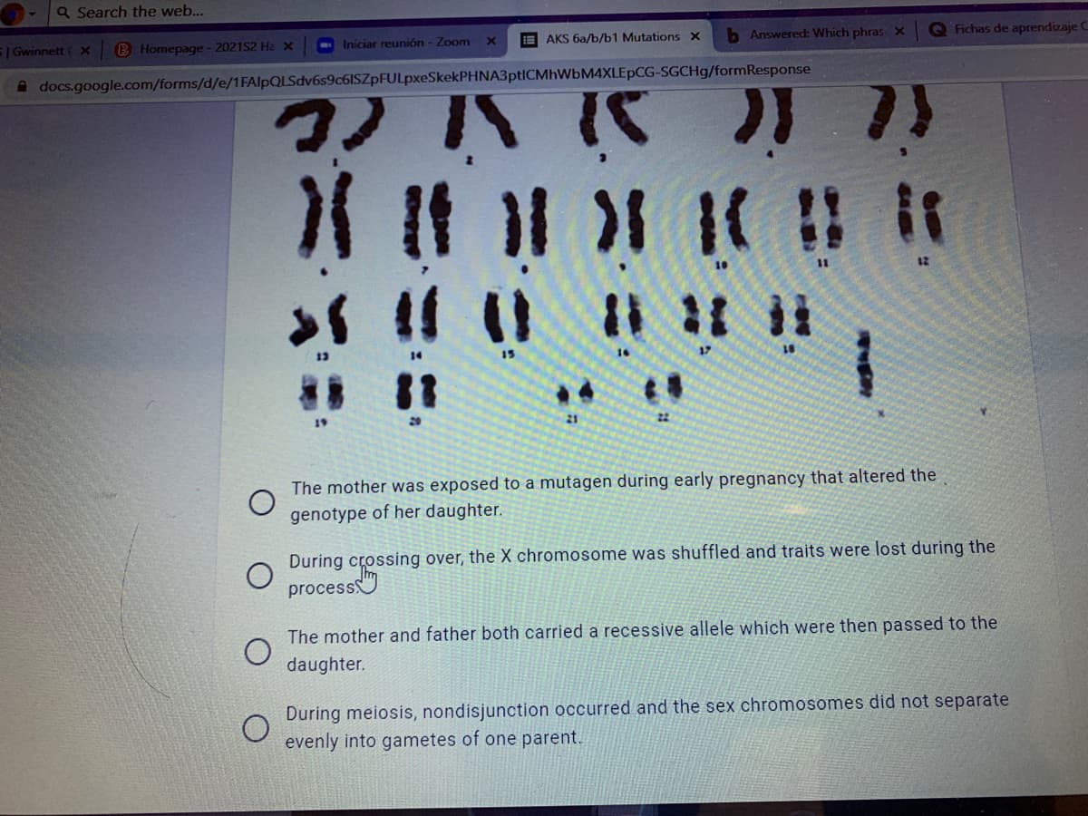 Q Search the web...
S| Gwinnett ( X
B Homepage - 2021S2 Ha x
- Iniciar reunión - Zoom
IEAKS 6a/b/b1 Mutations X
b Answered: Which phras X
Q Fichas de aprendizaje C
A docs.google.com/forms/d/e/1FAlpQLSdv6s9c6ISZpFULpxeSkekPHNA3ptICMhWÜM4XLEpCG-SGCH9/formResponse
コノハバ月 )
12
15
19
20
The mother was exposed to a mutagen during early pregnancy that altered the
genotype of her daughter.
During crossing over, the X chromosome was shuffled and traits were lost during the
process
The mother and father both carried a recessive allele which were then passed to the
daughter.
During meiosis, nondisjunction occurred and the sex chromosomes did not separate
evenly into gametes of one parent.
