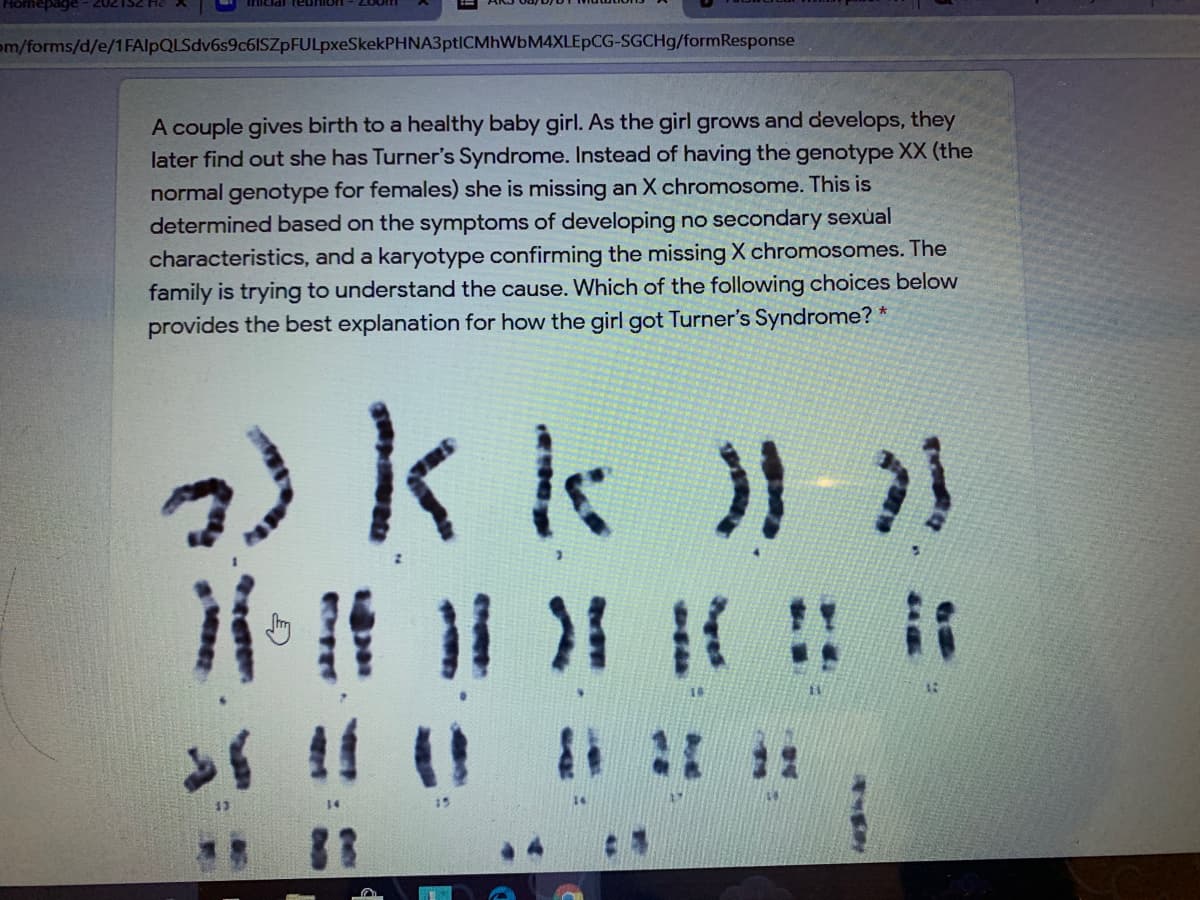 page - 202
ihiciar reun
om/forms/d/e/1FAlpQLSdv6s9c6ISZpFULpxeSkekPHNA3ptICMhWbM4XLEpCG-SGCH9/formResponse
A couple gives birth to a healthy baby girl. As the girl grows and develops, they
later find out she has Turner's Syndrome. Instead of having the genotype XX (the
normal genotype for females) she is missing an X chromosome. This is
determined based on the symptoms of developing no secondary sexual
characteristics, and a karyotype confirming the missing X chromosomes. The
family is trying to understand the cause. Which of the following choices below
provides the best explanation for how the girl got Turner's Syndrome? *
14
