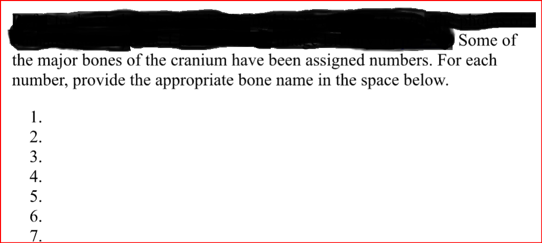 Some of
the major bones of the cranium have been assigned numbers. For each
number, provide the appropriate bone name in the space below.
-2345ON
1.
2.
3.
4.
5.
6.
7.