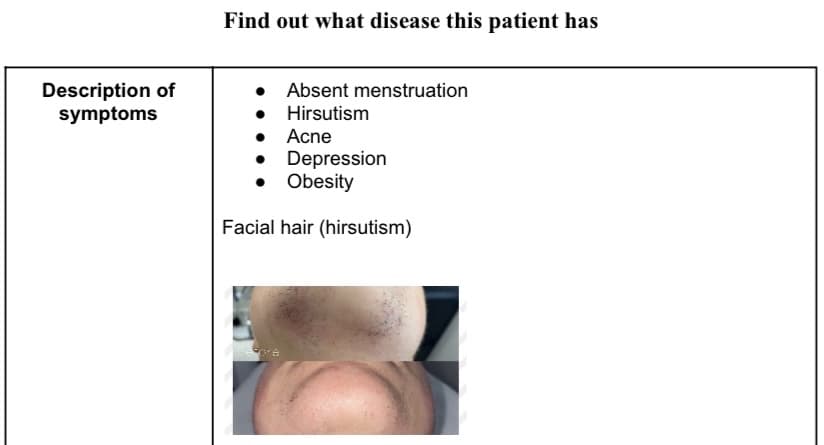 Description of
symptoms
Find out what disease this patient has
• Absent menstruation
•
Hirsutism
Acne
Depression
•
• Obesity
Facial hair (hirsutism)