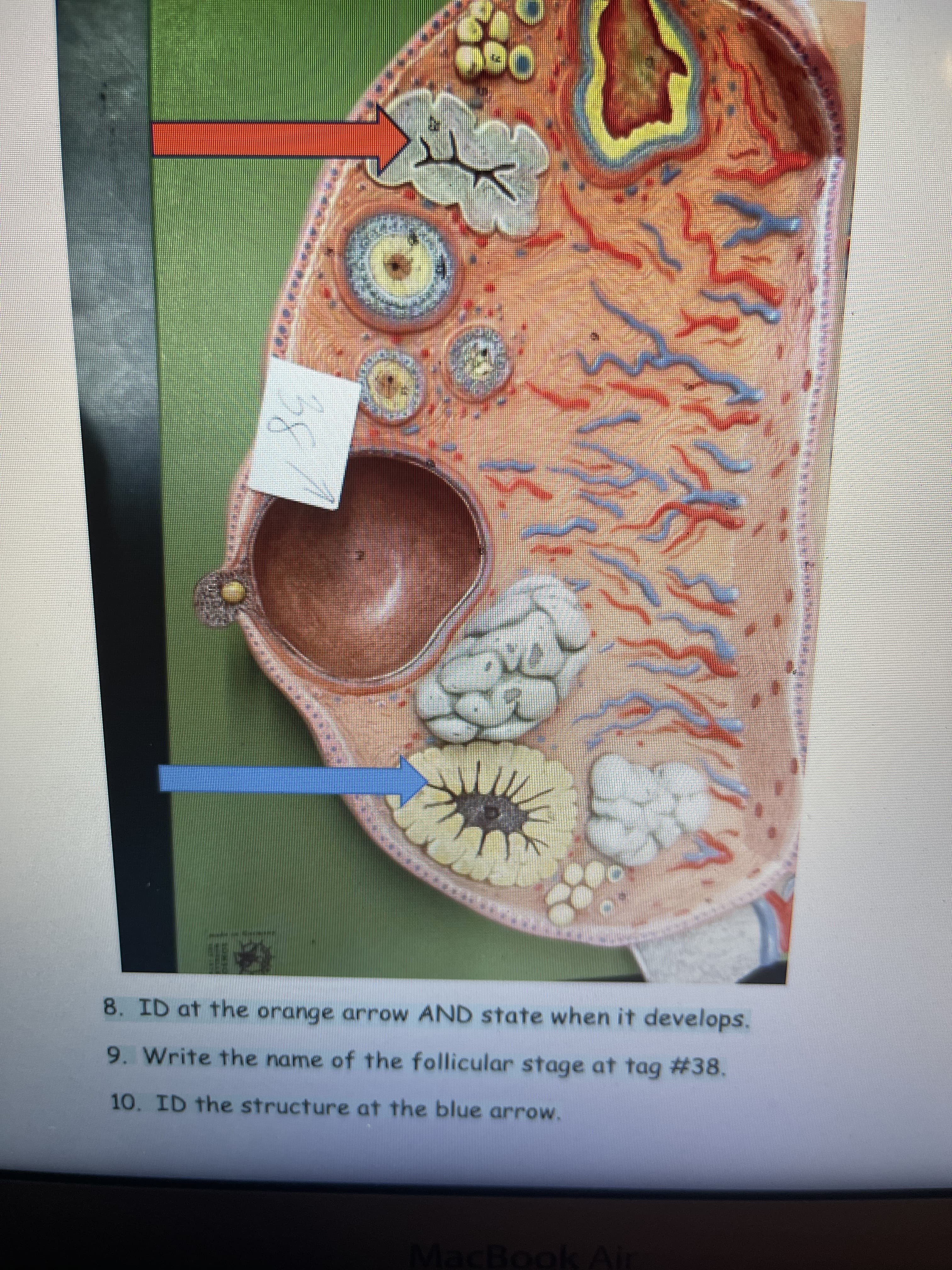 8. ID at the orange arrow AND state when it develops.
9. Write the name of the follicular stage at tag #38.
10. ID the structure at the blue arrow.
MacBook Air
