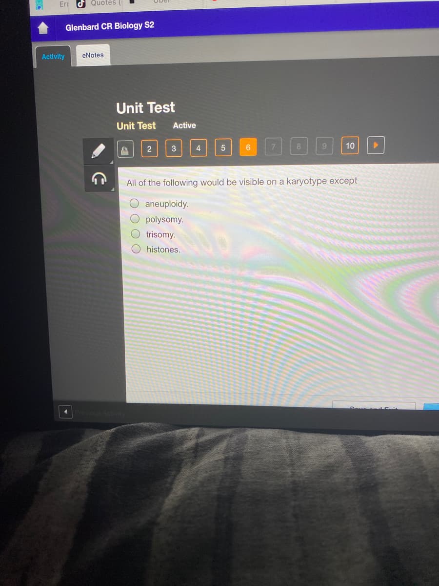 Eri
d Quotes
Glenbard CR Biology S2
Activity
eNotes
Unit Test
Unit Test
Active
8
10
2
All of the following would be visible on a karyotype except
aneuploidy.
O polysomy.
trisomy.
histones.
OO O O
