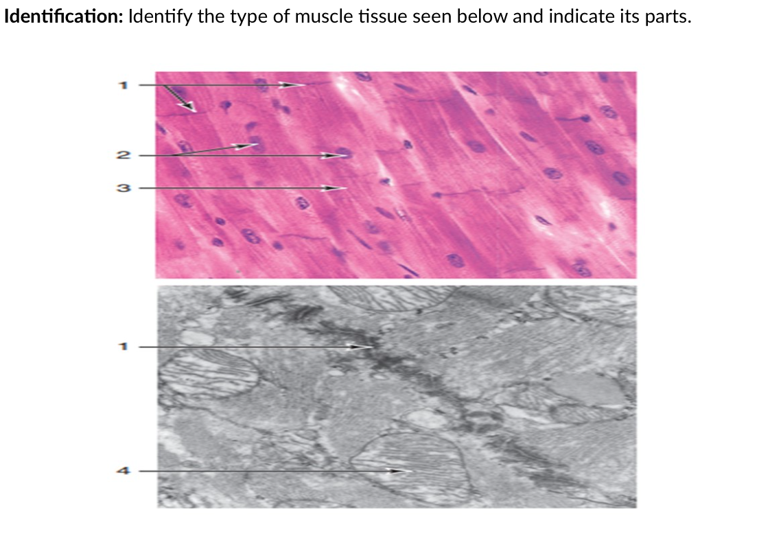 Identification: Identify the type of muscle tissue seen below and indicate its parts.
