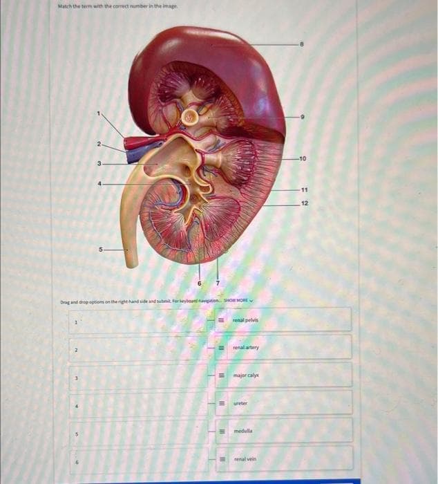 Match the term with the correct number in the image.
2
3
Drag and drop options on the right hand side and submit. For keyboard navigation SHOW MORE
renal pelvis
renal artery
major calyx
ureter
medulla
renal vein
-10
11
12