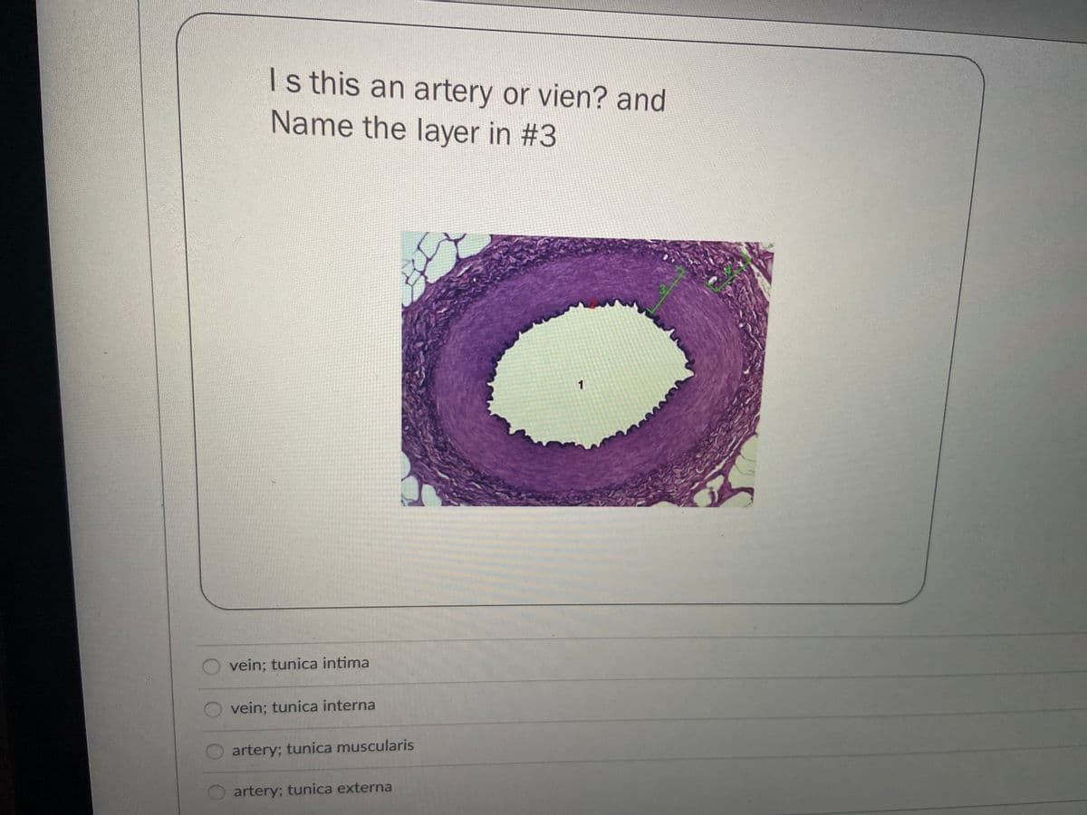 Is this an artery or vien? and
Name the layer in #3
vein; tunica intima
O vein; tunica interna
O artery; tunica muscularis
artery; tunica externa
O O0 O
