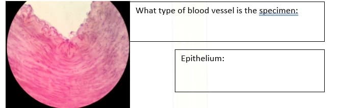 What type of blood vessel is the specimen:
Epithelium:
