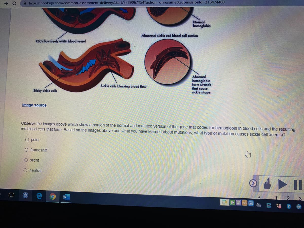 A bcps.schoology.com/common-assessment-delivery/start/3289067154?action3Donresume&submissionld%3D316474480
Normal
hemoglobin
Abnormal sickle red blood cell section
RBCs flow freely whitin blood vessel
Abormal
hemoglobin
form strands
that cause
sickle shape
Sickle cells blocking blood flow
Sticky sickle cells
Image source
Observe the images above which show a portion of the normal and mutated version of the gene that codes for hemoglobin in blood cells and the resulting
red blood cells that form. Based on the images above and what you have learned about mutations, what type of mutation causes sickle cell anemia?
O point
O frameshift
O silent
O neutral
II
