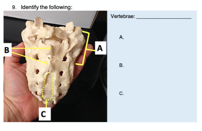 9. Identify the following:
Vertebrae:
А.
B
A
В.
C.
B.
