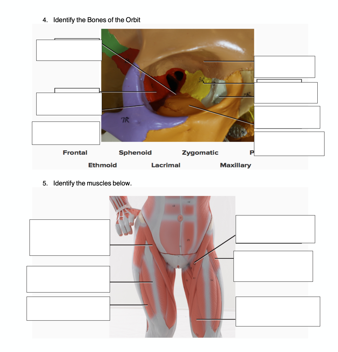 4. Identify the Bones of the Orbit
7R
Frontal
Sphenoid
Zygomatic
Ethmoid
Lacrimal
Maxillary
5. Identify the muscles below.
