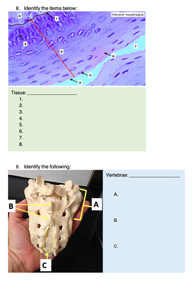 8. Identify the items below:
Viscera: esophagus
Tissue:
1.
2.
3.
4.
5.
6.
7.
8.
9. Identify the following:
Vertebrae:
А.
В
A
В.
C.
