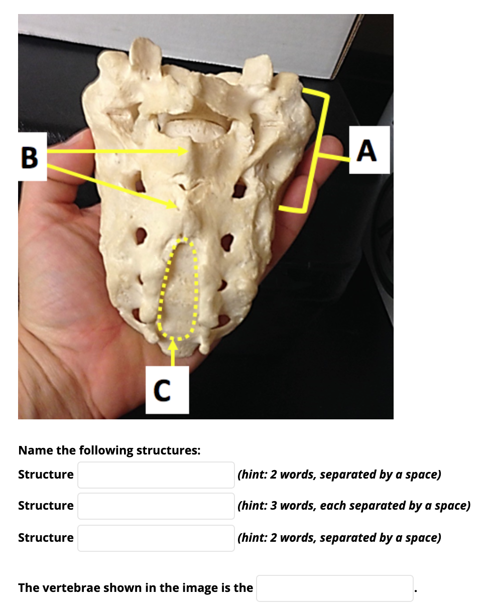 В
A
C
Name the following structures:
Structure
(hint: 2 words, separated by a space)
Structure
(hint: 3 words, each separated by a space)
Structure
(hint: 2 words, separated by a space)
The vertebrae shown in the image is the
