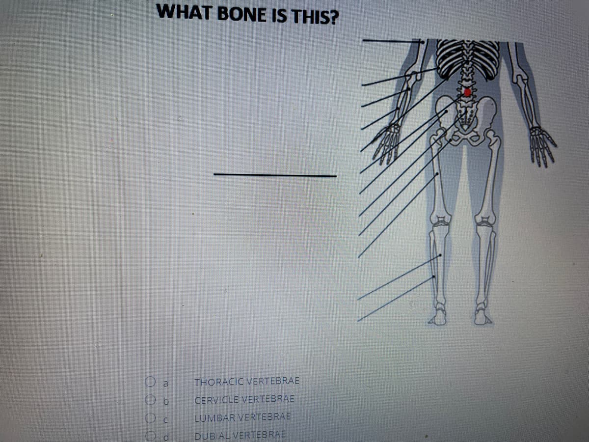 WHAT BONE IS THIS?
a
THORACIC VERTEBRAE
CERVICLE VERTEBRAE
LUMBAR VERTEBRAE
DUBIAL VERTEBRAE
