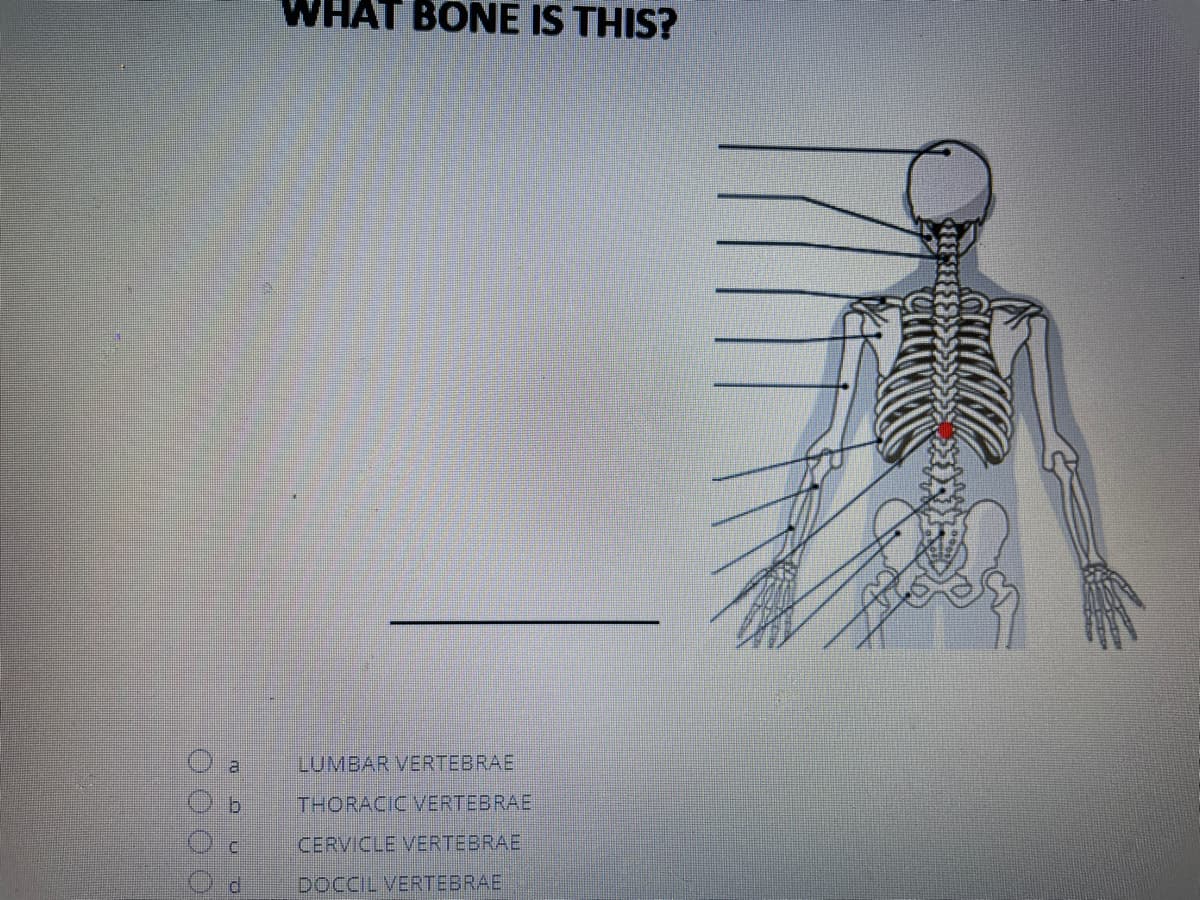 WHAT BONE IS THIS?
al
LUMBAR VERTEBRAE
b.
THORACIC VERTEBRAE
CERVICLE VERTEBRAE
DOCCIL VERTEBRAE
