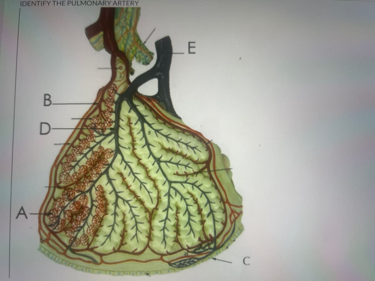 IDENTIFY THE PULMONARY ARTERY
A-
B.
D
E
C