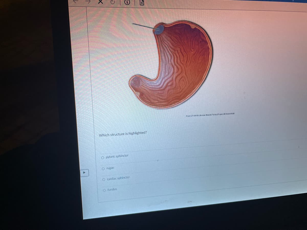 Piam LTVAIL Me Terka atJs Siee
Which structure is highlighted?
O pyloric sphincter
O rugae
O cardiac sphincter
O fundus
