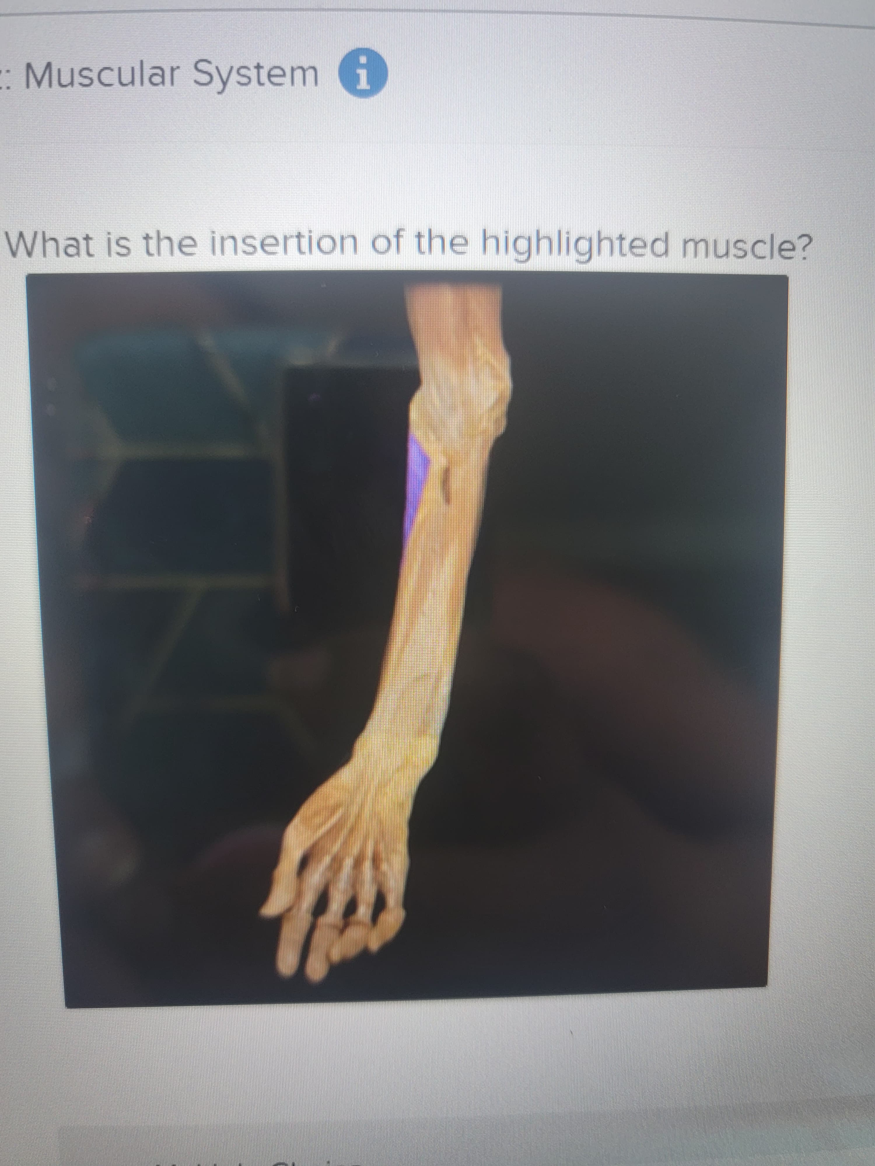 : Muscular System i
What is the insertion of the highlighted muscle?

