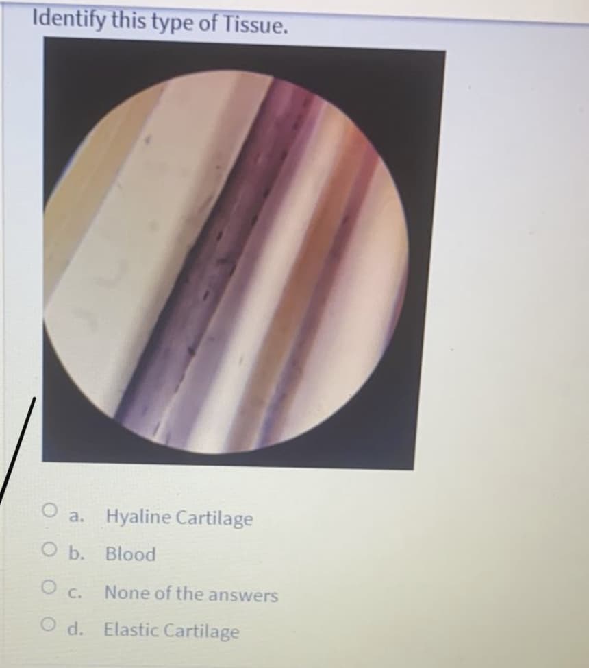 Identify this type of Tissue.
O a. Hyaline Cartilage
О Ь. Blood
None of the answers
O c.
O d. Elastic Cartilage

