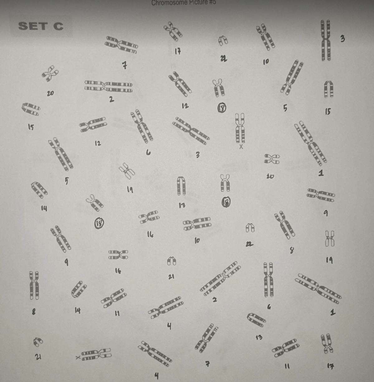 SET C
15
20
14
21
LIV
5
W
14
CHA
TD
12
IDD
(18)
2
7
UD
Hf
11
35
19
Chromosome Picture #5
16
4
17
21
4
ODLEEN DEC
CENE
12
LEMLERD
T
3
10
D
Y
22
678
22
10
ED
13
D
D
20
MIDD
5
D
15
1
19
ACHIED
N
3
+