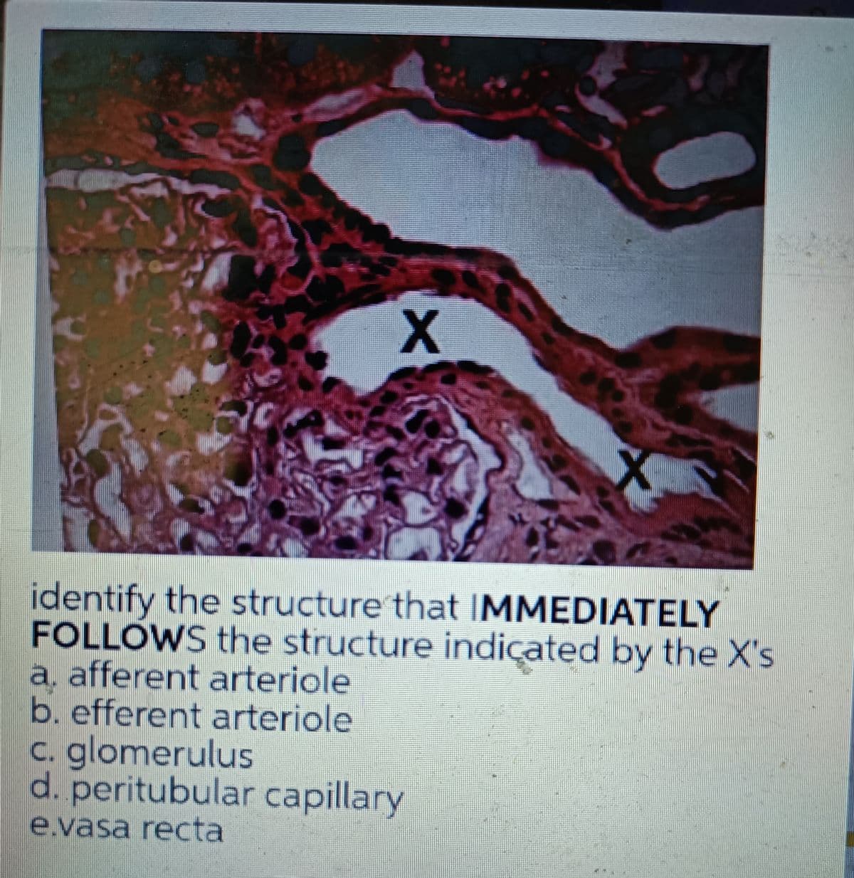 X
identify the structure that IMMEDIATELY
FOLLOWS the structure indicated by the X's
a. afferent arteriole
b. efferent arteriole
c. glomerulus
d. peritubular capillary
e.vasa recta