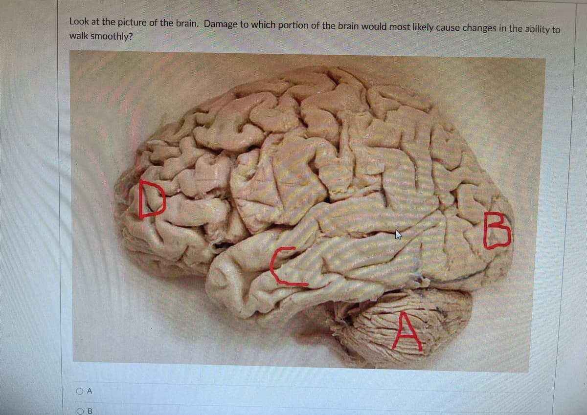 Look at the picture of the brain. Damage to which portion of the brain would most likely cause changes in the ability to
walk smoothly?
O A
