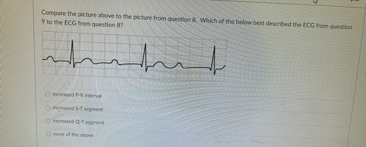 Compare the picture above to the picture from question 8. Which of the below best described the ECG from question
9 to the ECG from question 8?
O increased P-R interval
O increased S-T segment
O increased Q-T segment
O none of the above
