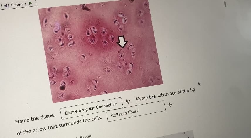 Listen
Dense Irregular Connective
Name the tissue.
of the arrow that surrounds the cells.
Saved
A Name the substance at the tip
A/
Collagen fibers
1