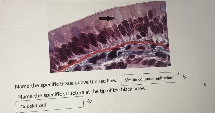 Simple columnar epithelium
Name the specific tissue above the red line.
Name the specific structure at the tip of the black arrow.
Gobelet cell
A
A