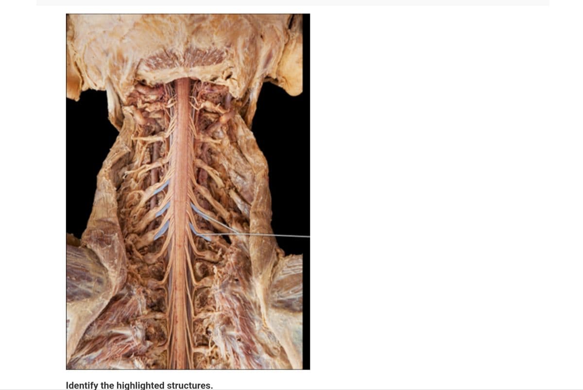 Identify the highlighted structures.