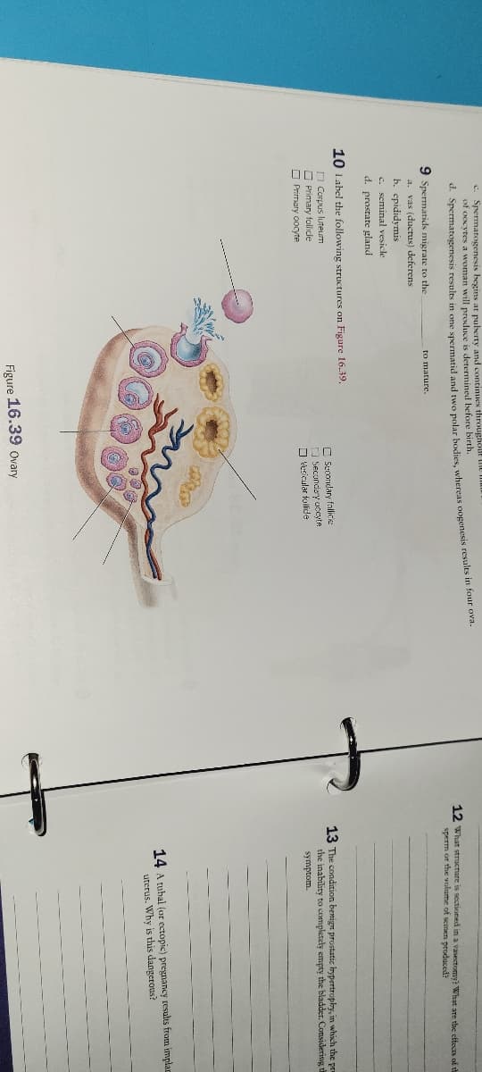 c. Spermatogenesis begins at puberty and continues throughout the
of oocytes a woman will produce is determined before birth.
d. Spermatogenesis results in one spermatid and two polar bodies, whereas oogenesis results in four ova.
9 Spermatids migrate to the
a. vas (ductus) deferens
b. epididymis
c. seminal vesicle
d. prostate gland
to mature.
10 Label the following structures on Figure 16.39.
Corpus luteum
Primary follicle
Primary oocyte
Secondary follicie
Secondary accyte
Vesicular follide
Figure 16.39 Ovary
12 What structure is sectioned in a vasectomy? What are the effects of th
sperm or the volume of semen produced?
13 The condition benign prostatic hypertrophy, in which the pra
the inability to completely empty the bladder. Considering th
symptom.
14 A tubal (or ectopic) pregnancy results from implan
uterus. Why is this dangerous?