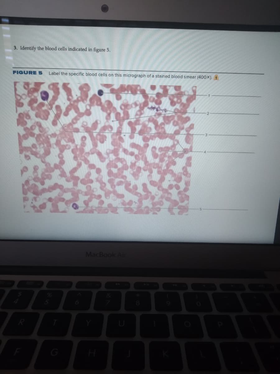 3. Identify the blood cells indicated in figure 5.
FIGURE 5 Label the specific blood cells on this micrograph of a stained blood smear (400x).
R
99g
5
MacBook Air
D
8
K
